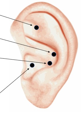 DIY Ear Seeds for Anxiety